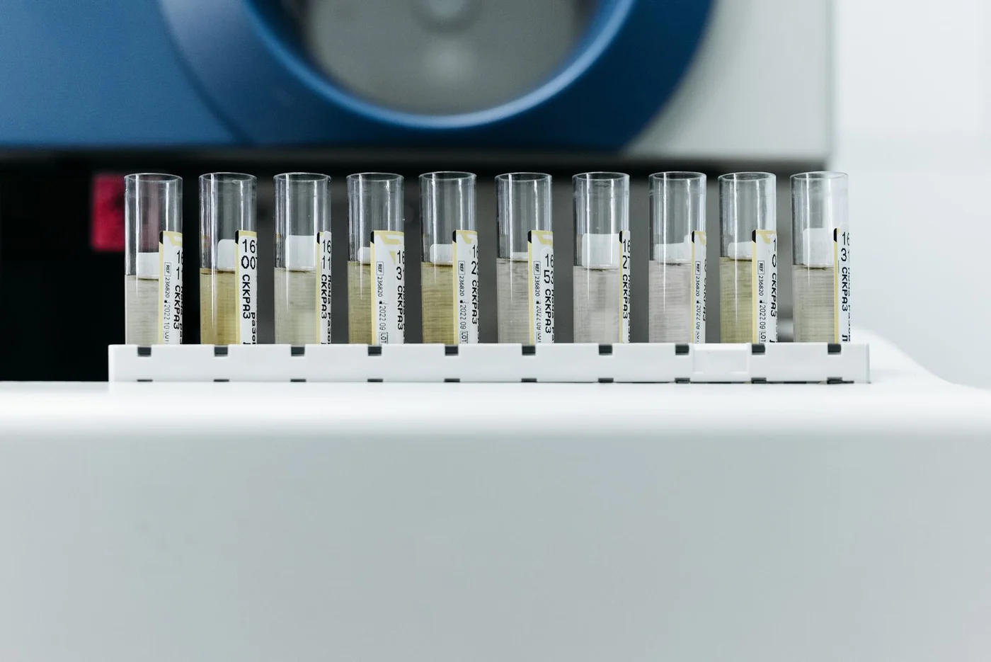 Sample tubes arranged in a rack in front of laboratory equipment